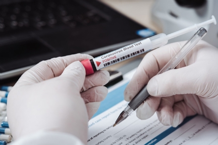 VIRUS - ASL TO 5: Test sierologici per il personale delle scuole